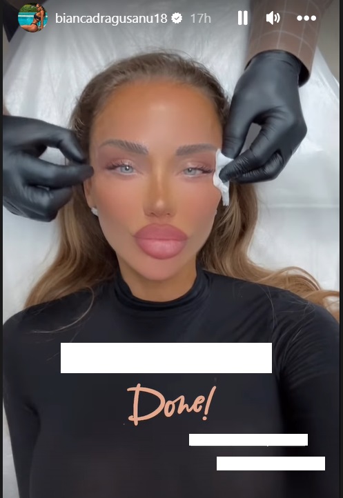 Cum arată Bianca Drăgușanu după cea mai nouă intervenție estetică la față. Ce presupune procedura „cat eye”
