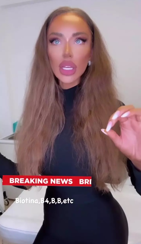 Cum arată Bianca Drăgușanu fără extensii sau peruci. „Decoloratul mi-a distrus părul”