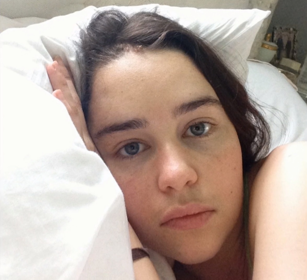 FOTO | Emilia Clarke, din Game of Thrones, imagini de pe patul de spital după operațiile pe creier la care a fost supusă