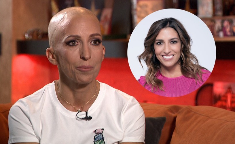 Rubint Réka bevallotta, így élte meg, hogy kihullott a haja – videó