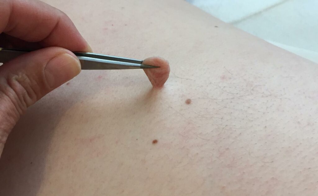 Skin