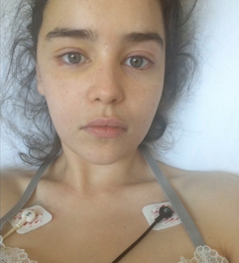 FOTO | Emilia Clarke, din Game of Thrones, imagini de pe patul de spital după operațiile pe creier la care a fost supusă