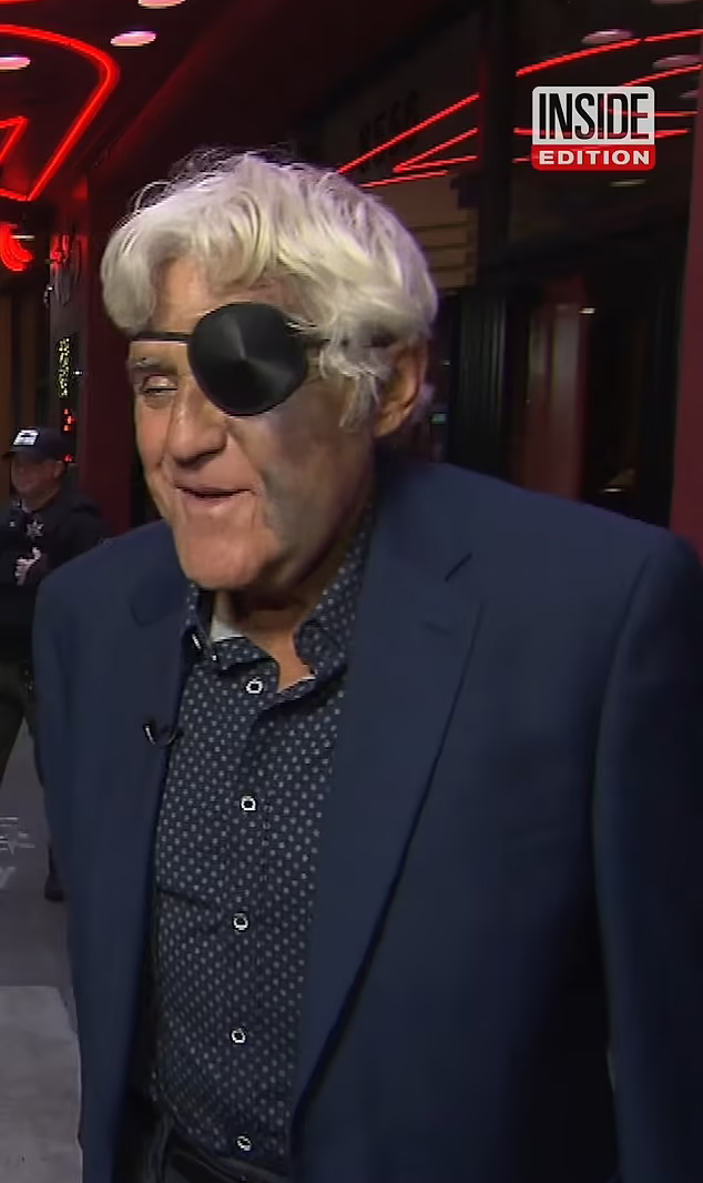 Sokkoló baleset! Félszemű lett a legendás Jay Leno - fotó