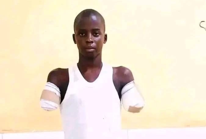 12-year-old's arms cut off by uncle over alleged phone theft; NBA demands justice