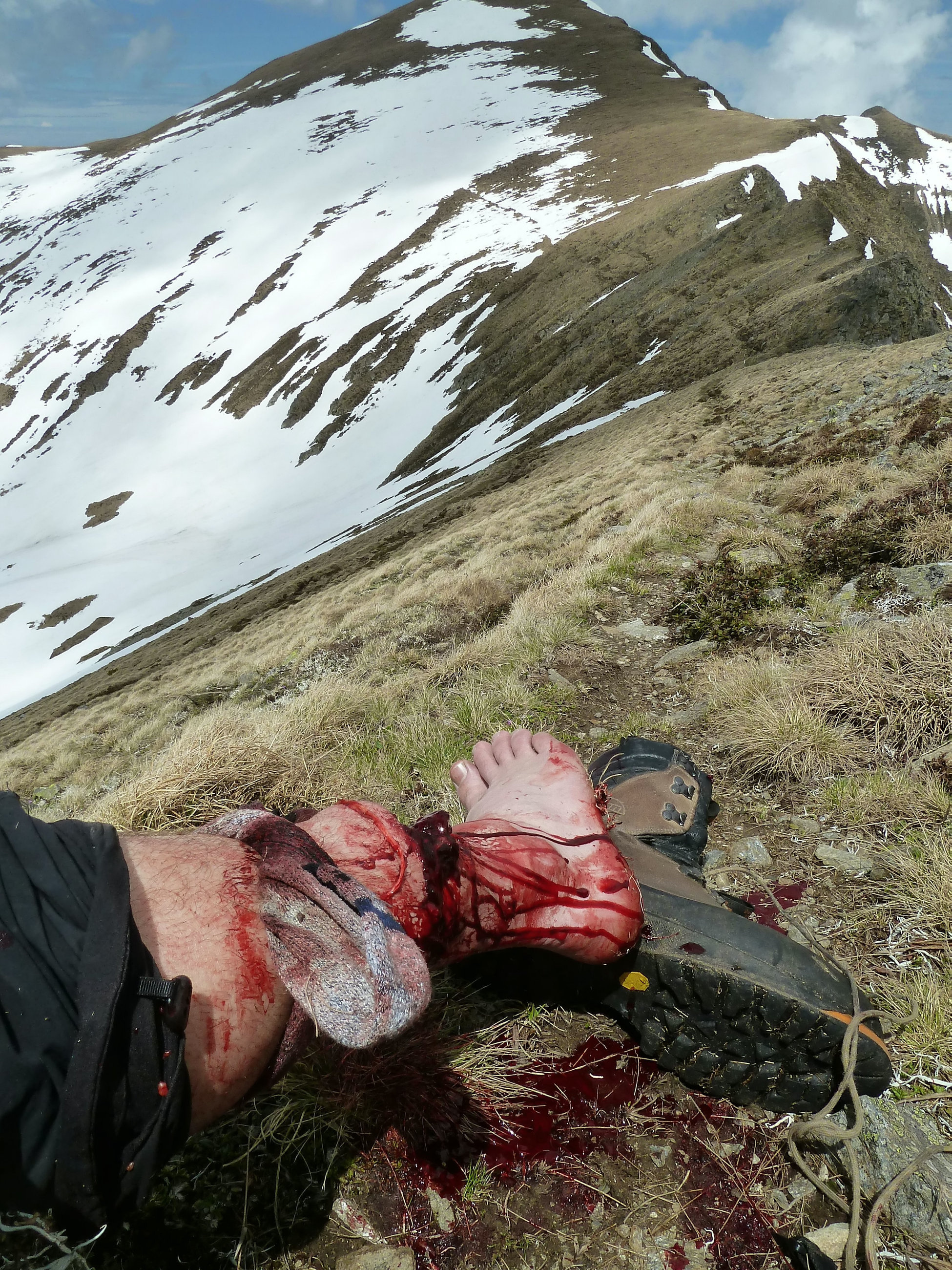 GALERIE FOTO | Cum i-a salvat o britanică viața iubitului ei atacat de un urs în România