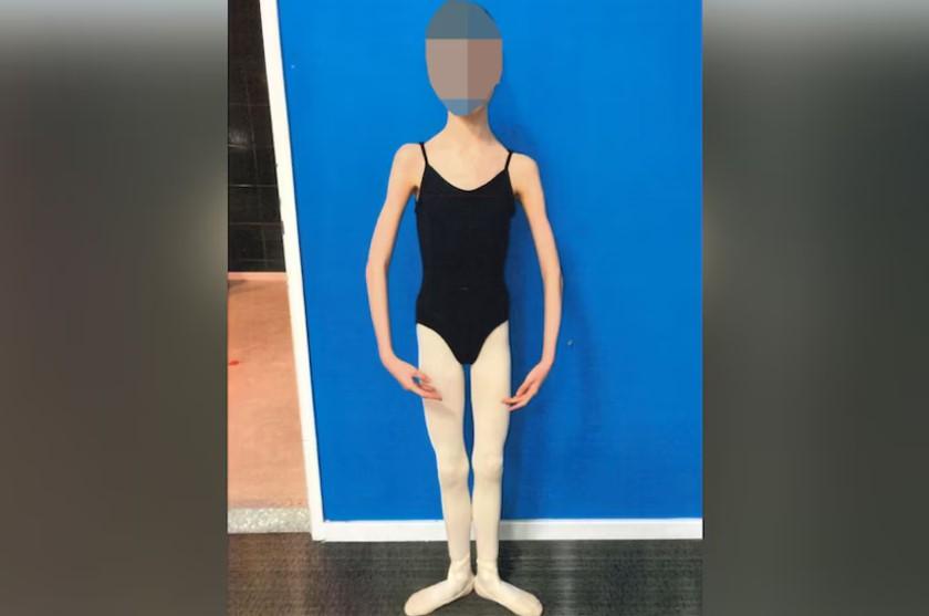 Doi părinți și-au înfometat fiica pentru că doreau să rămână mică. Fata de 17 ani ajunsese să cântărească 27,3 kilograme