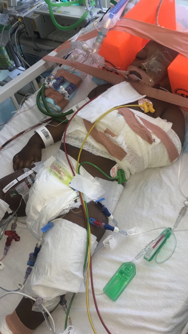 FOTO | Un copil-miracol a sfidat moartea în urma unei căzături de la etaj. Medicii l-au deconectat de la aparate, iar el a început să respire imediat fără probleme