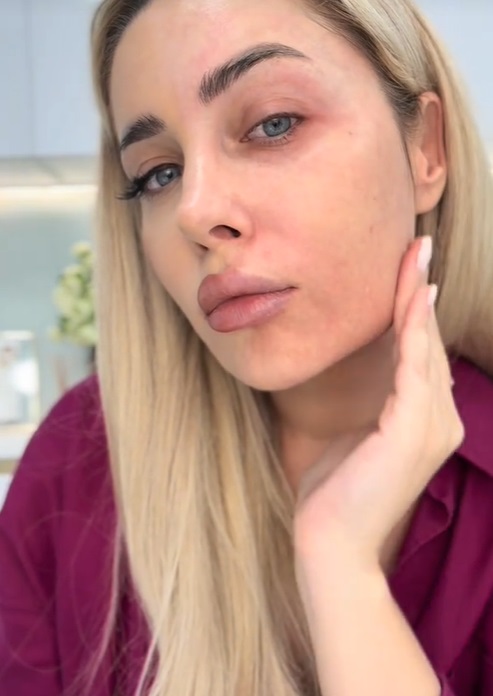 Cum arată Oana Monea nemachiată. Și-a șters make-up-ul în fața fanilor ei: „Aud mereu același lucru: «Ai riduri! De ce nu le injectezi»”