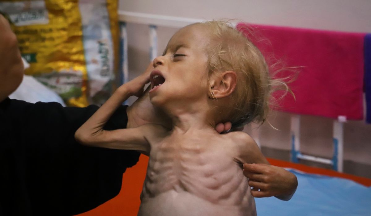 Povestea fetiței de 2 ani evacuată din Gaza și salvată de medici în Italia în ultimul moment: cântărea doar patru kilograme