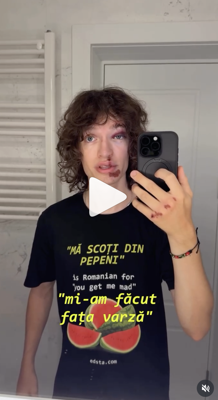 Ce a pățit un influencer venit din SUA după ce a mers cu trotineta prin București: „Noroc că eram în fața spitalului”