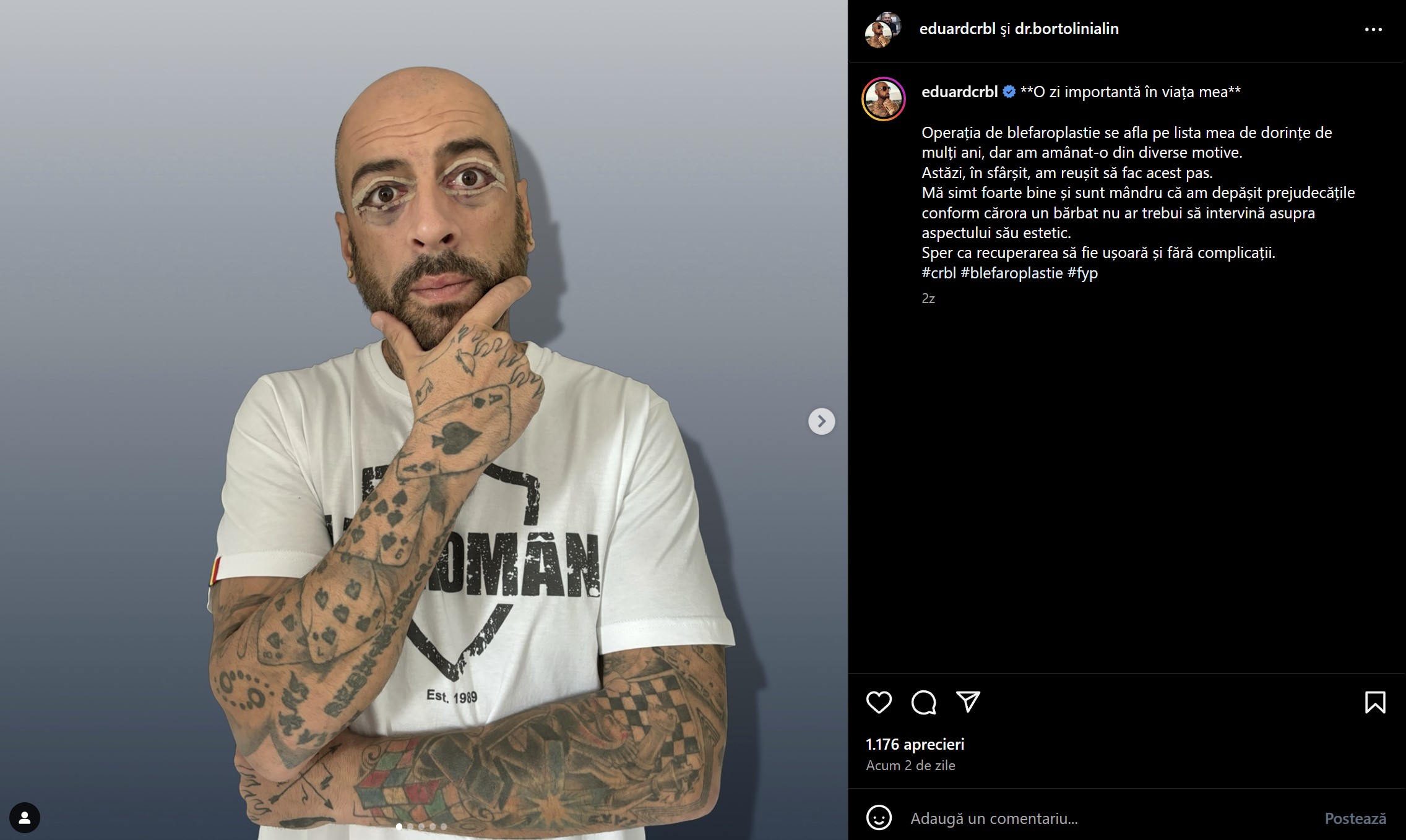CRBL, noi detalii despre intervențiile la care a apelat. Artistul se va lăsa din nou pe mâna specialiștilor pentru transformarea fizică. „Am intrat într-o revizie”