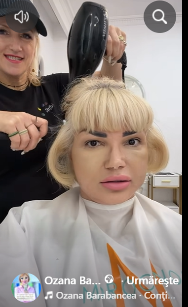 Transformarea Ozanei Barabancea, la o lună după operația de lifting facial