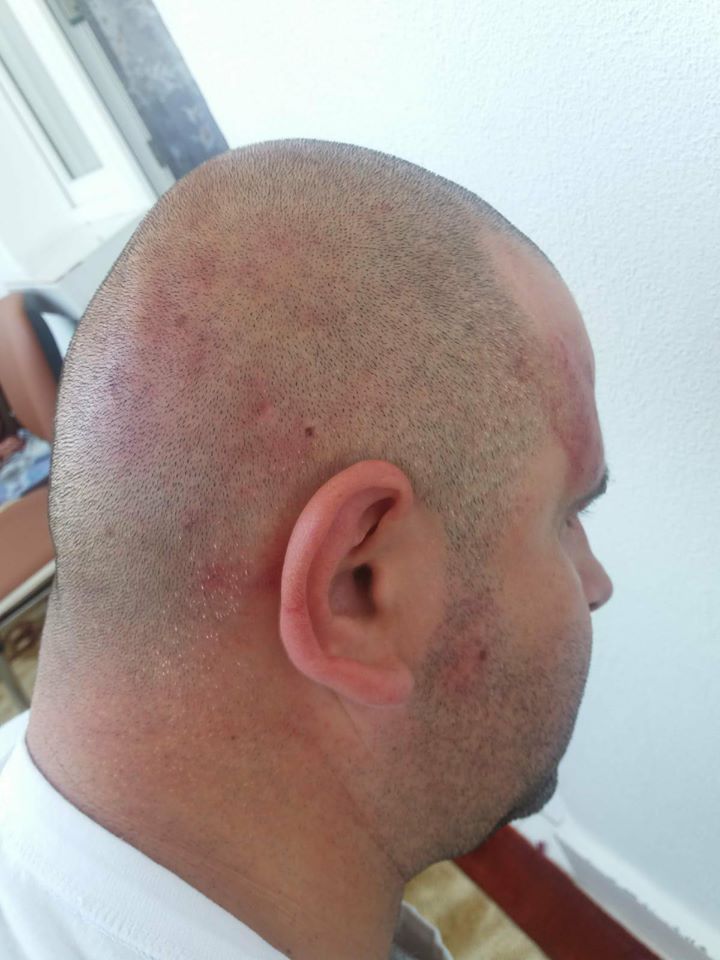 Un polițist din Piatra Neamț a fost bătut și lăsat fără încărcător. A primit pumni în cap pentru ca pistolul să nu ajungă la agresori