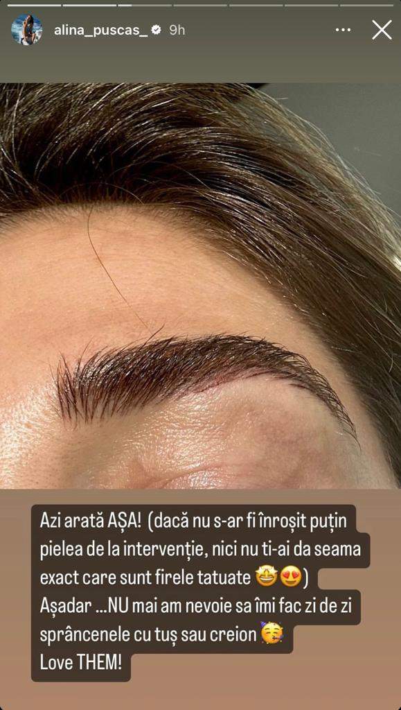 Cum arată Alina Pușcaș după ce și-a tatuat sprâncenele. „Știu că multe dintre voi aveți nevoie”