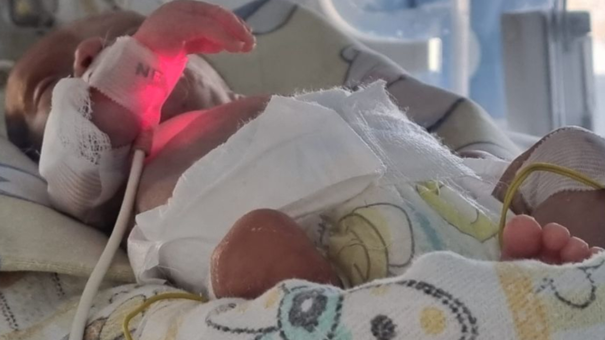Un bebeluș născut prematur în Timișoara este învingător, după ce la naștere a cântărit 550 de grame