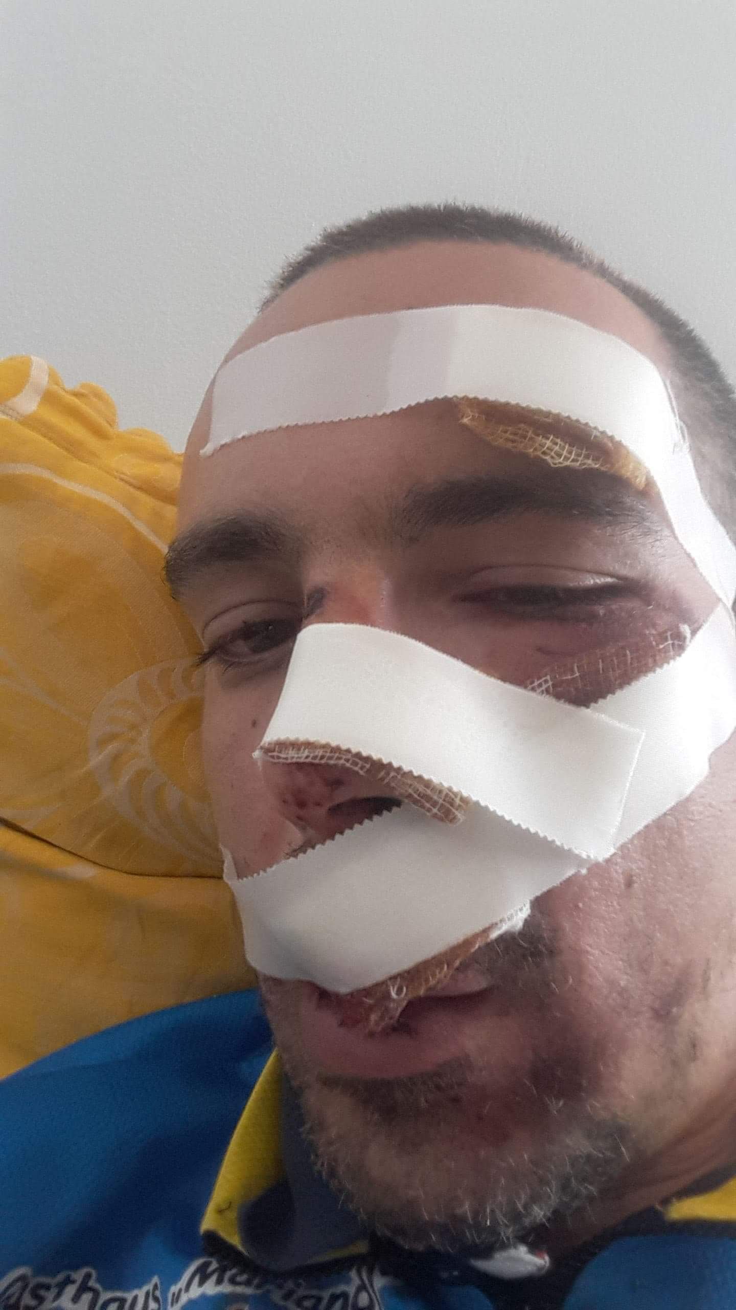 Domnule primar Robu, aveți grijă când mergeți cu bicicleta prin Timișoara! Puteți ajunge așa, ca tânărul care a căzut în groapa de pe trotuar