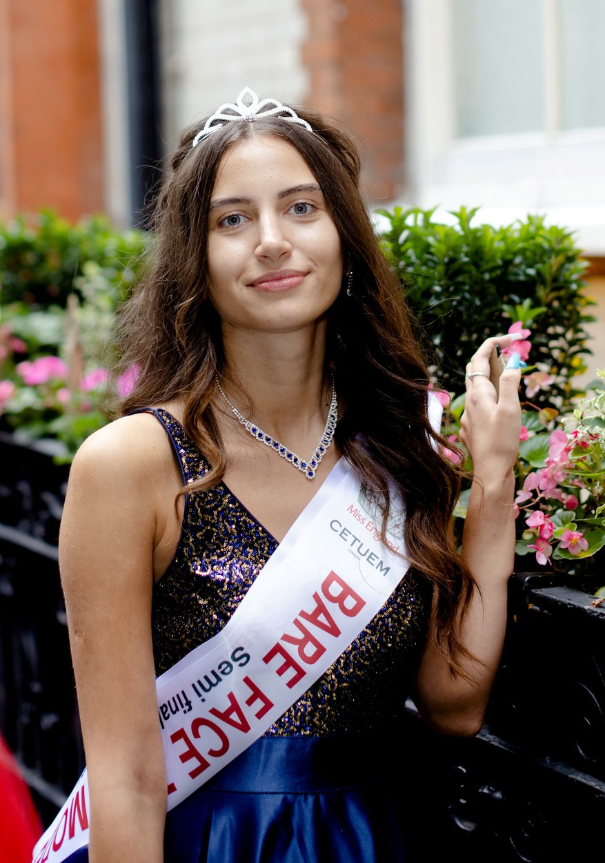 Niciodată în istoria de 100 de ani a Miss Anglia nu s-a mai întâmplat așa ceva: o tânără de 20 de ani concurează fără machiaj. „Defectele noastre ne fac să fim cine suntem” - FOTO