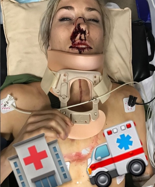 Frumoasa ciclistă Caroline Bouchanan a suferit răni grave după un accident de circulație! Atenție, imagini care vă pot afecta emoțional! Foto în articol