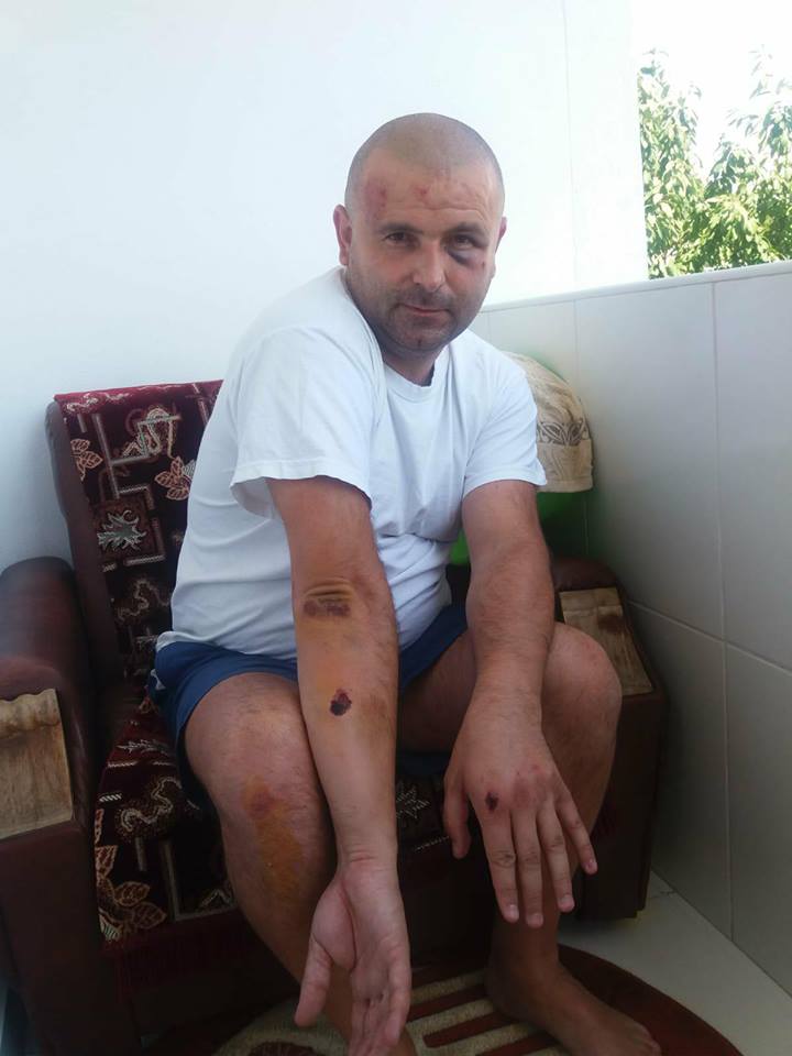 Un polițist din Piatra Neamț a fost bătut și lăsat fără încărcător. A primit pumni în cap pentru ca pistolul să nu ajungă la agresori