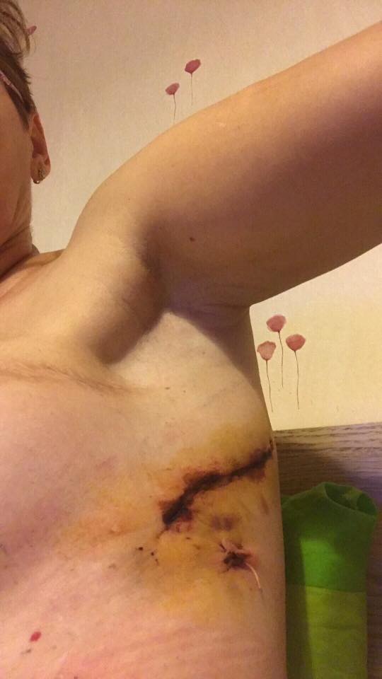 Ce se întâmplă cu jurnalista Miriam, bolnavă de cancer. "Am esofagul zdrențe" | FOTO