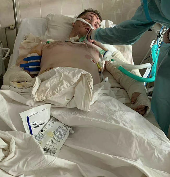 „Un haos”. Un veteran ucrainean care se afla la protezare în străinătate, după ce și-a pierdut picioarele în luptele din Donbas, a primit citație de înrolare
