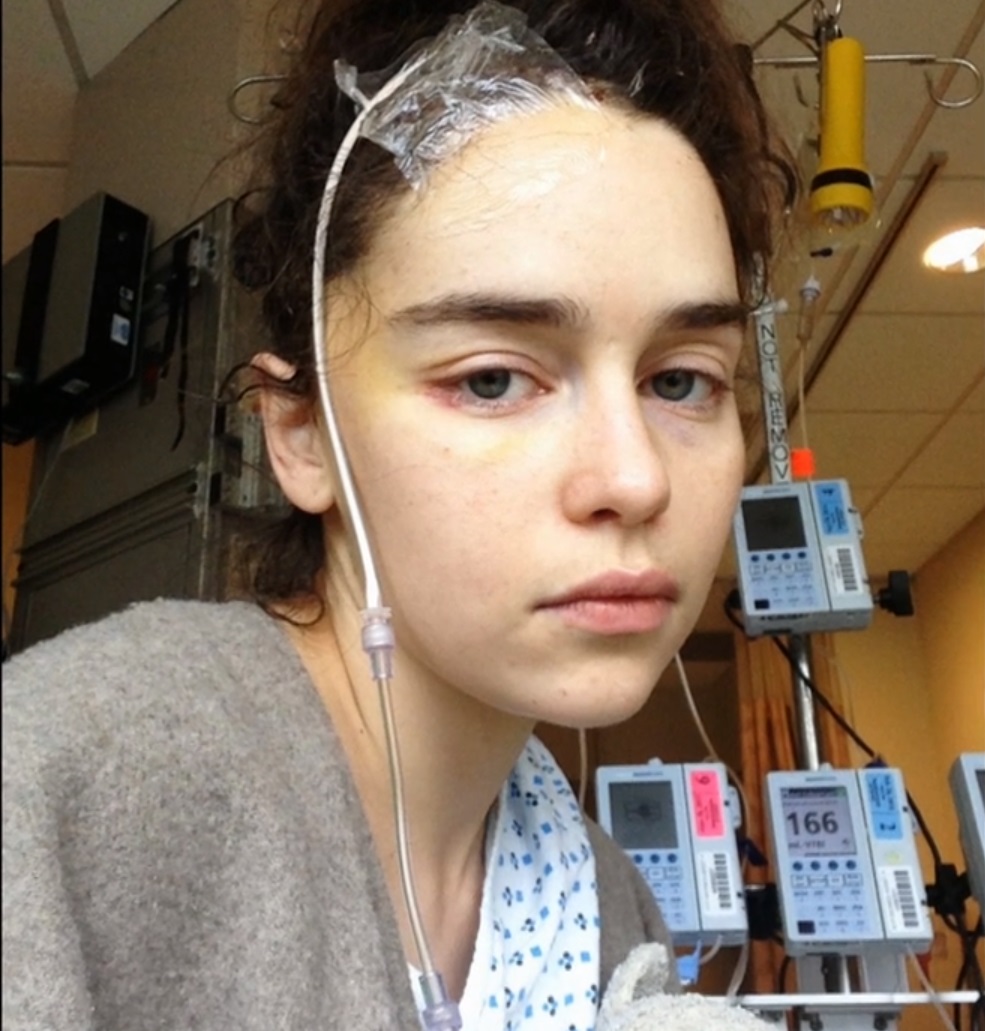 FOTO | Emilia Clarke, din Game of Thrones, imagini de pe patul de spital după operațiile pe creier la care a fost supusă
