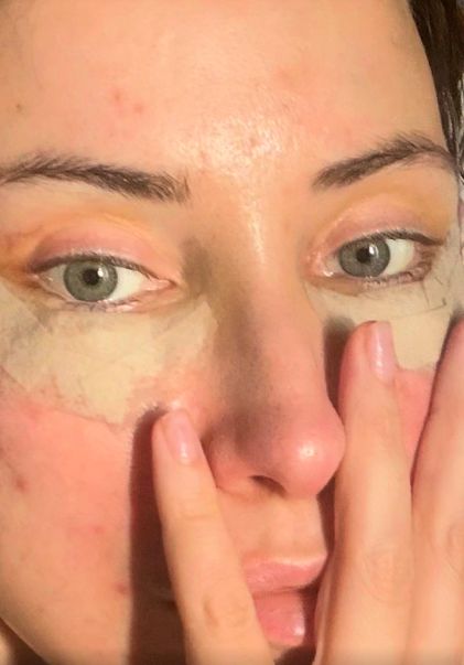 Iulia Albu, sinceră despre intervențiile estetice: „Mi-am dorit un deep plane facelift. Fără filtre, fără vrăjeală”