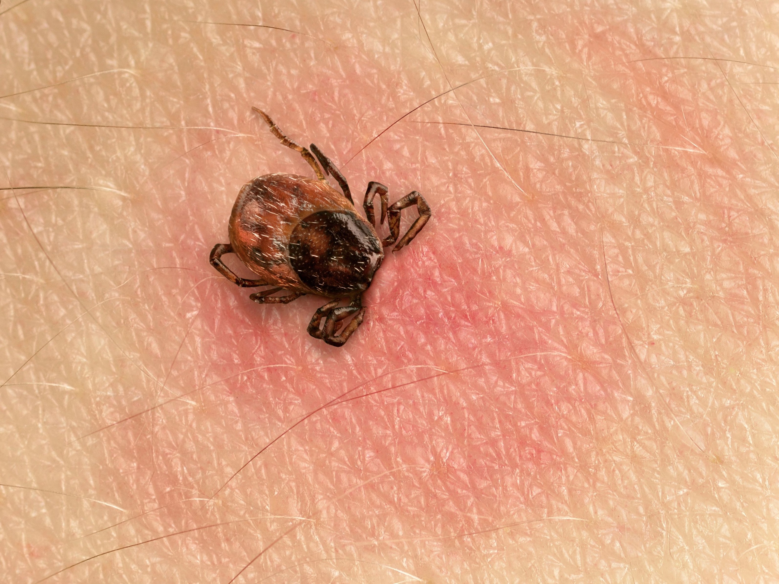 Enfermedad de Lyme: estos son los primeros síntomas tras una picadura de garrapata