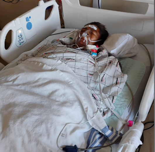 Doctorii i-au amputat brațele și picioarele, după atacul unui pitbull: „Mă întreb cât poate îndura un om. Dar e puternică, va reuși”