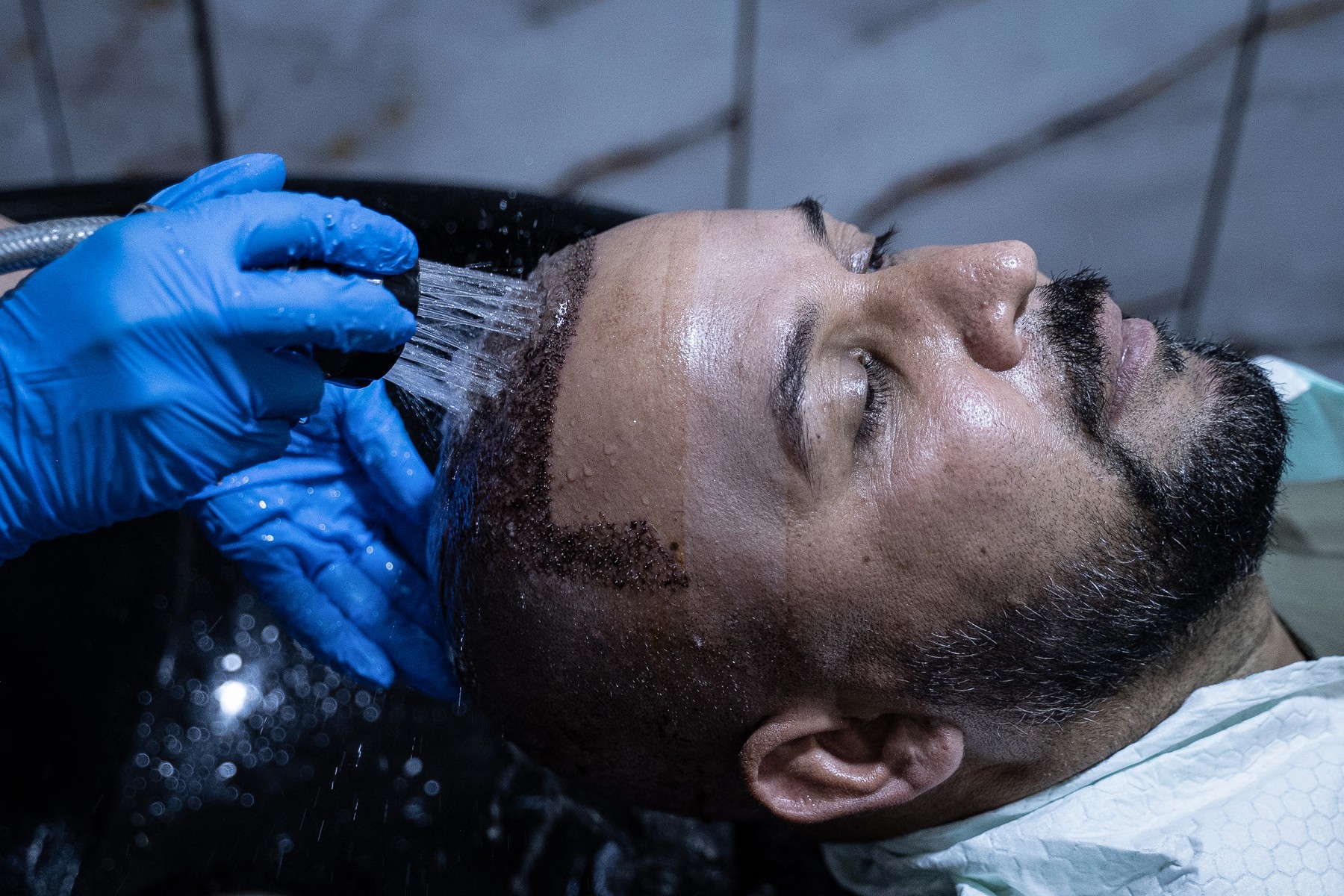 Chirurgia estetică înflorește în secret în Afganistan, sub nasul talibanilor: „Botox pe sub burka. Să fim frumoase în oglindă ne dă energie!”