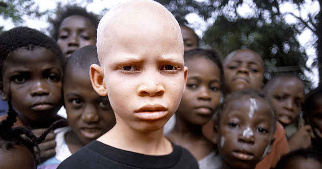 Albino-