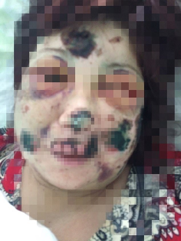O femeie a cunoscut online un bărbat și a mers la el acasă. Nu a știut că va da peste ”Hannibal Lecter” în versiune rusească. A fost mutilată | FOTO