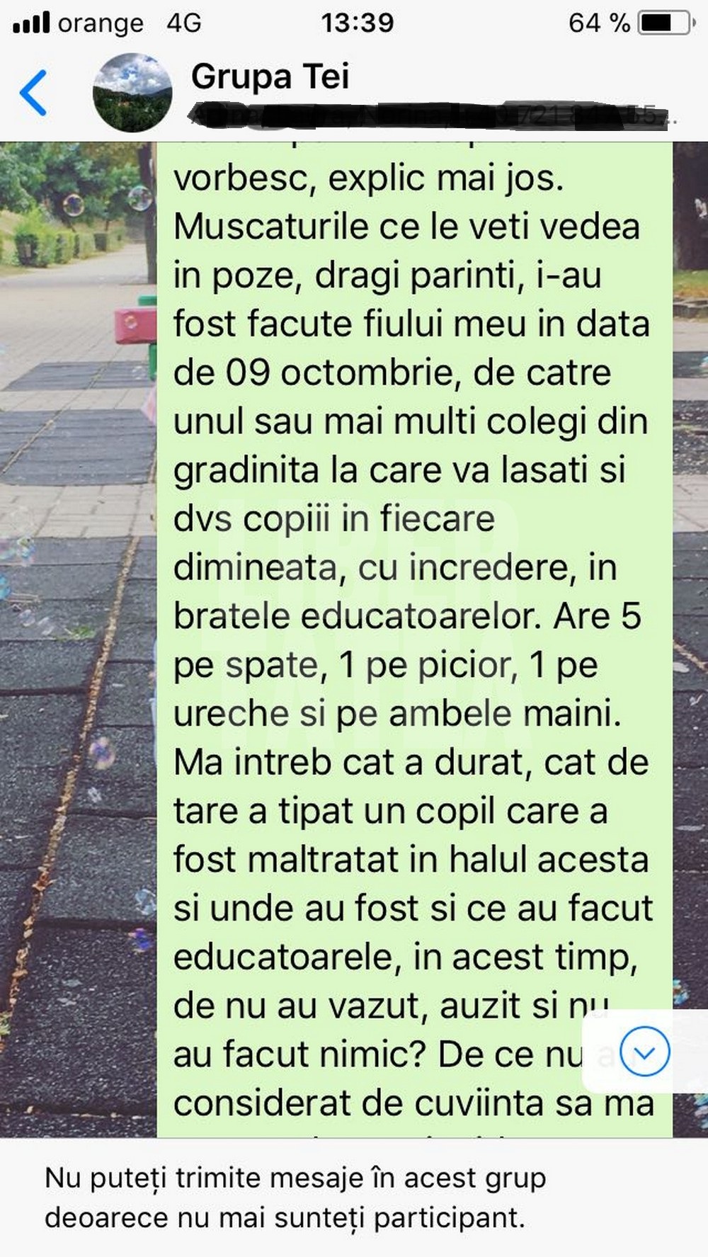 EXCLUSIV / Copil de 1 an și 8 luni, mușcat violent la grădiniță. Copilul a rămas cu traume