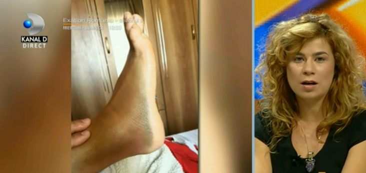 Problemele de sănătate ale Silviei Stroescu, prima eliminată de la Exatlon. "Din păcate, încă nu pot..." | FOTO