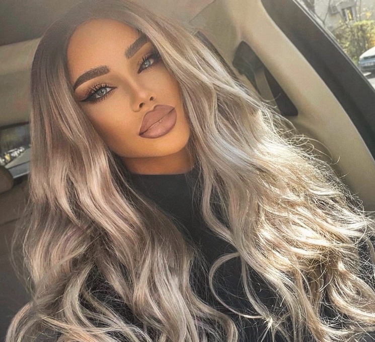 Decizia luată de Bianca Drăgușanu. De ce se operează iar: „Sunt mulțumită de aspectul meu, dar vreau să lansez un nou trend”