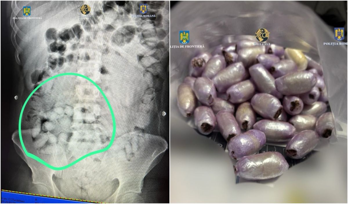 Un brazilian care înghițise capsule cu cocaină și avea altele lipite pe picioare, prins pe Aeroportul Otopeni din București - Foto