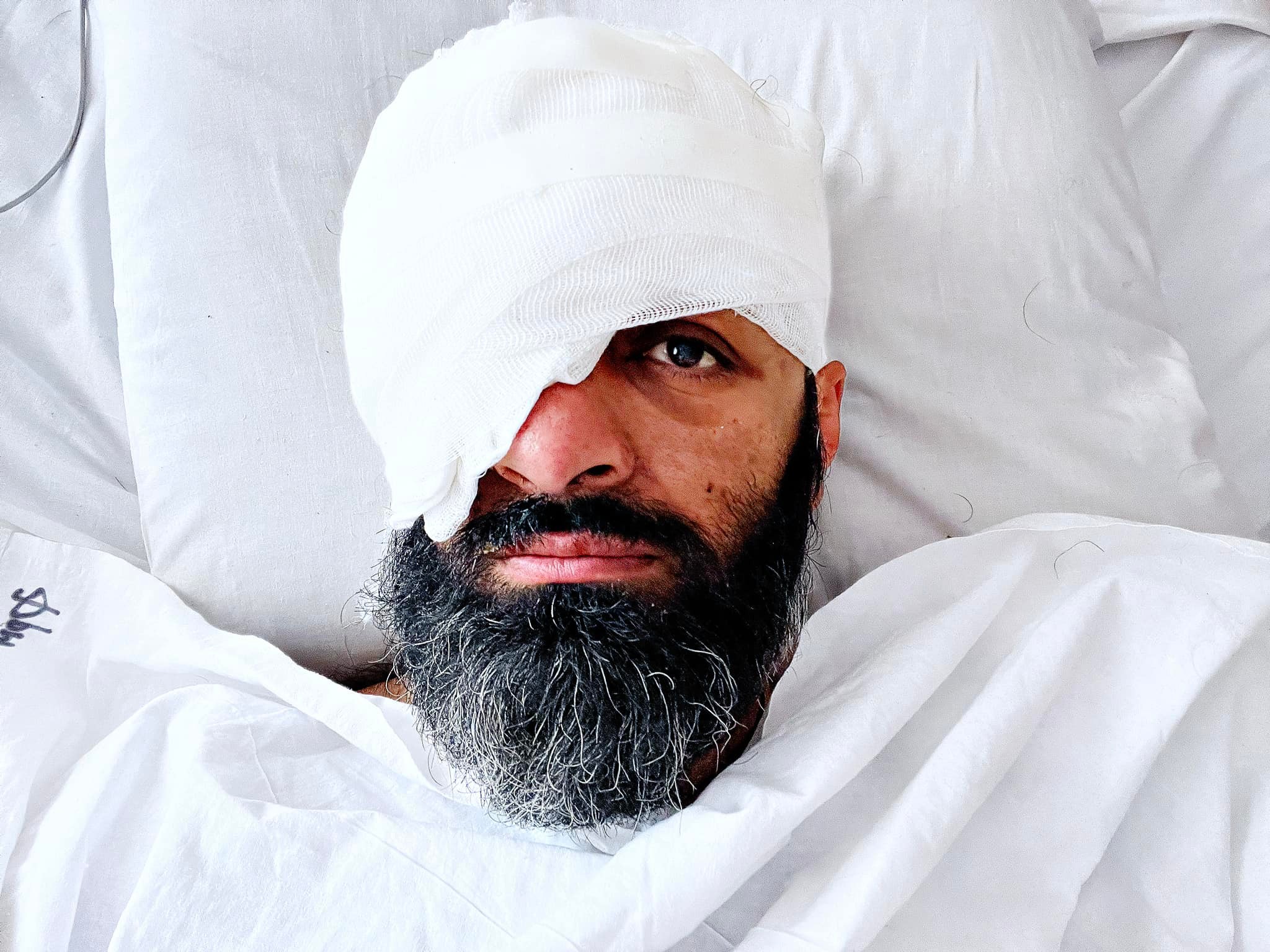 Soldat ucrainean care și-a pierdut ochiul drept pe front: „Cel mai rău este când îmi vine să plâng, dar nu mai pot”