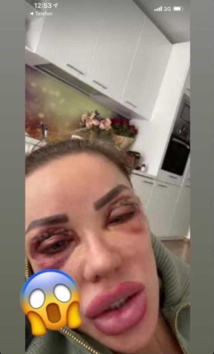 Vedete din România care au fost victime ale violenței domestice