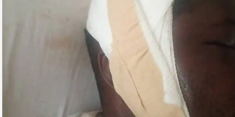 Man brutally beaten over alleged disappearance of Okada rider\'s penis at Senya Bereku
