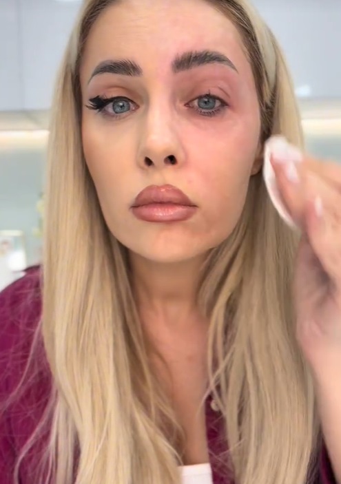 Cum arată Oana Monea nemachiată. Și-a șters make-up-ul în fața fanilor ei: „Aud mereu același lucru: «Ai riduri! De ce nu le injectezi»”