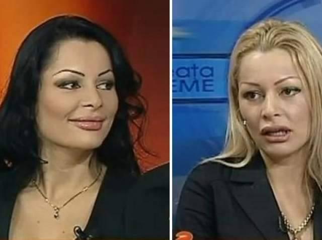Vedetele din România care au apelat la medicul estetician. Cum arătau înainte de intervenții