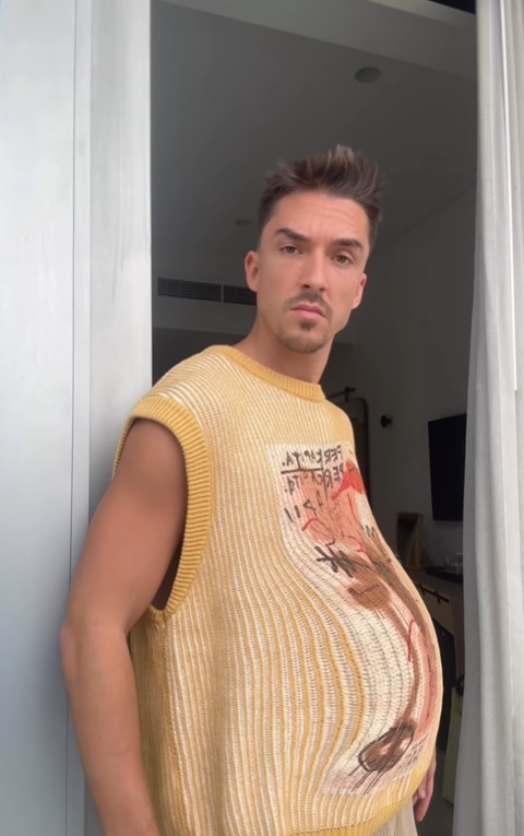 Reacții după ce Emil Rengle a folosit un filtru care imită sarcina. Fanii nu s-au abținut: „Chiar o să creadă lumea că ești gravid”