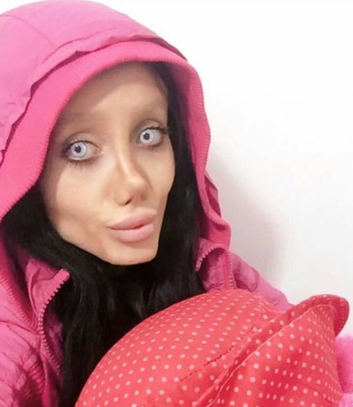 FOTO | Cum arată cu adevărat tânăra care a spus că a făcut 50 de operaţii pentru a avea chipul lui Angelina Jolie