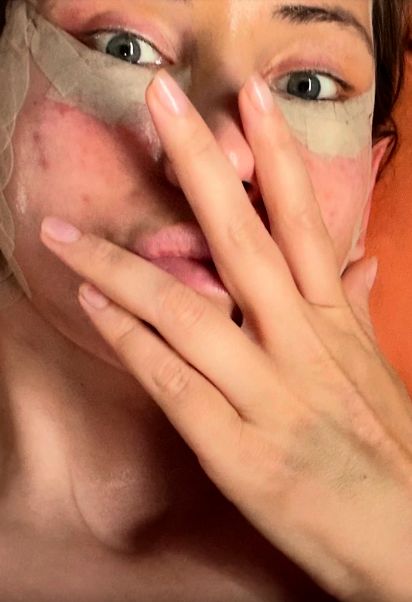 Iulia Albu, sinceră despre intervențiile estetice: „Mi-am dorit un deep plane facelift. Fără filtre, fără vrăjeală”