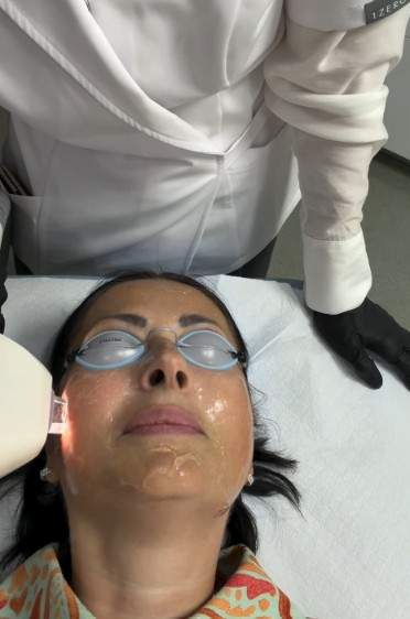 Gabriela Cristea și-a făcut terapie cu laser la față. Ce problemă a vrut să rezolve după cele două sarcini