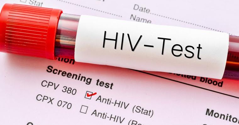 These 16 countries require an HIV/AIDS test before you can get a visa