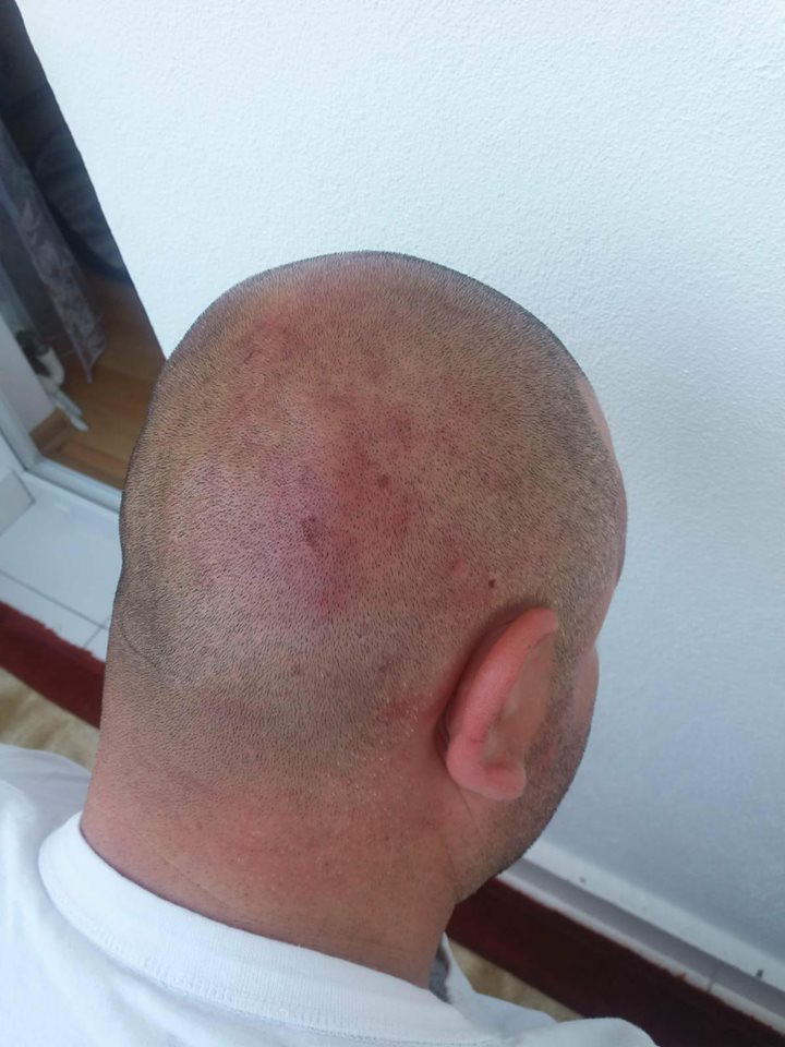 Un polițist din Piatra Neamț a fost bătut și lăsat fără încărcător. A primit pumni în cap pentru ca pistolul să nu ajungă la agresori
