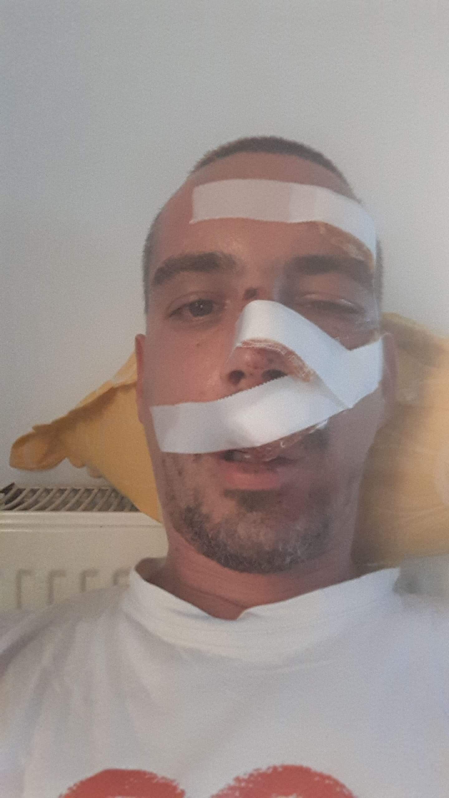 Domnule primar Robu, aveți grijă când mergeți cu bicicleta prin Timișoara! Puteți ajunge așa, ca tânărul care a căzut în groapa de pe trotuar
