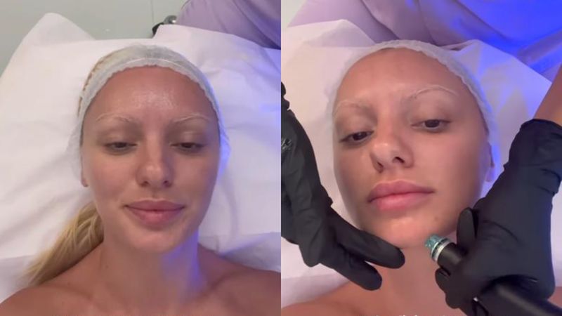 Alexandra Stan, din nou pe mâna medicului estetician. La ce procedură a apelat artista. „În sfârșit am ajuns pe patul meu preferat”