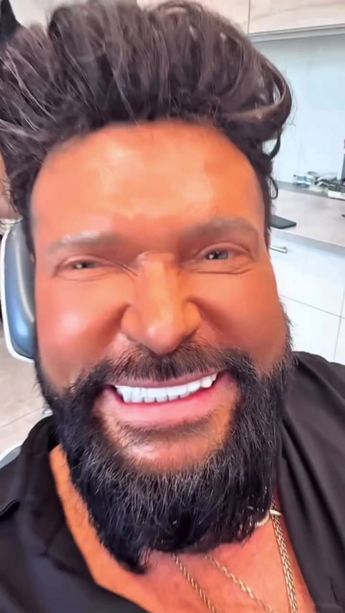 Krzysztof Rutkowski zafundował sobie nowe zęby. Fani mają mieszane opinie...